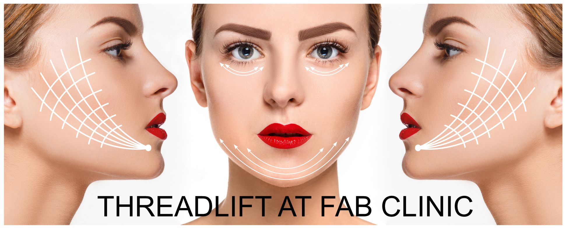 The young female face with clean fresh skin, antiaging and thread lifting concept
